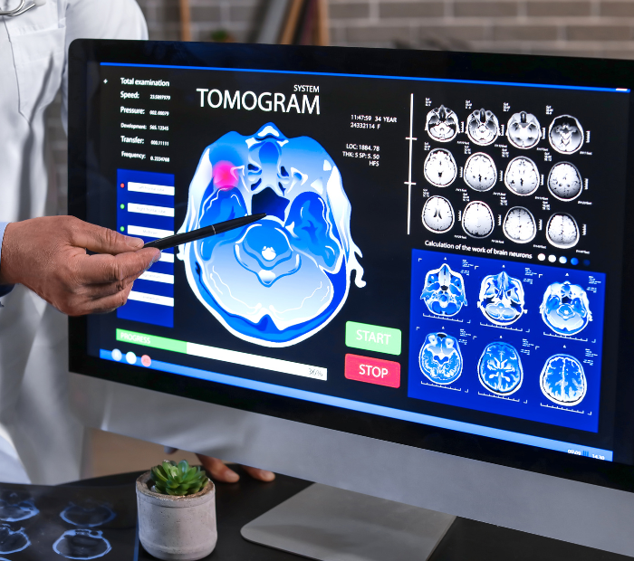 Neurology Department Illustration